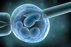 2024年格鲁吉亚三代试管婴儿全部费用大概多少钱？附详细费用介绍！