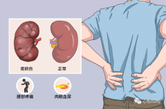 肾虚会导致不孕吗 女人肾虚怎么调理