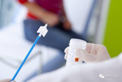 白带常规清洁度一般多少度？白带常规清洁度多少算正常？