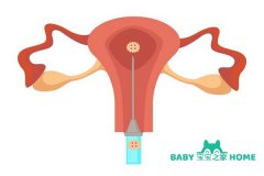 35岁高龄女性做试管移植后怎样做才更容易着床？