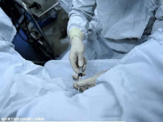 超高龄试管用什么方案检查？超高龄试管用什么方案检查比较好？