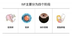 试管助孕关键一步--促排卵要注意什么？